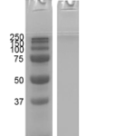 SPR-536_Alpha-Synuclein-1-114-Monomers-C-term-Truncated-Protein-SDS-Page-1.png