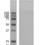 SPR-538_Alpha-Synuclein-E83Q-Mutant-Monomers-Protein-SDS-Page-1.png